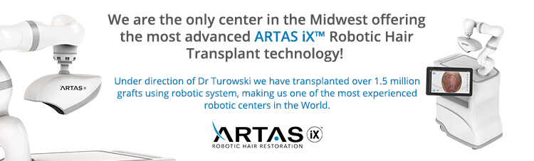 Artas Robotic Hair Restoration