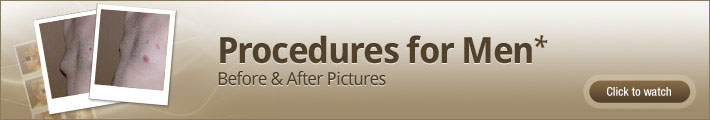Procedures for Men – Before & After Pictures Procedures for Men – Before & After Pictures